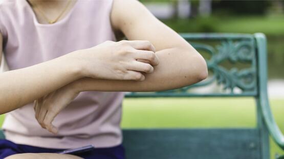 HautjuckenJuckreiz – was tun?